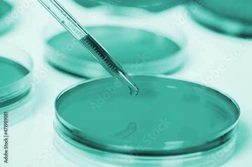 Medical abstract background. Petri dishes and glass pipette on the desk.