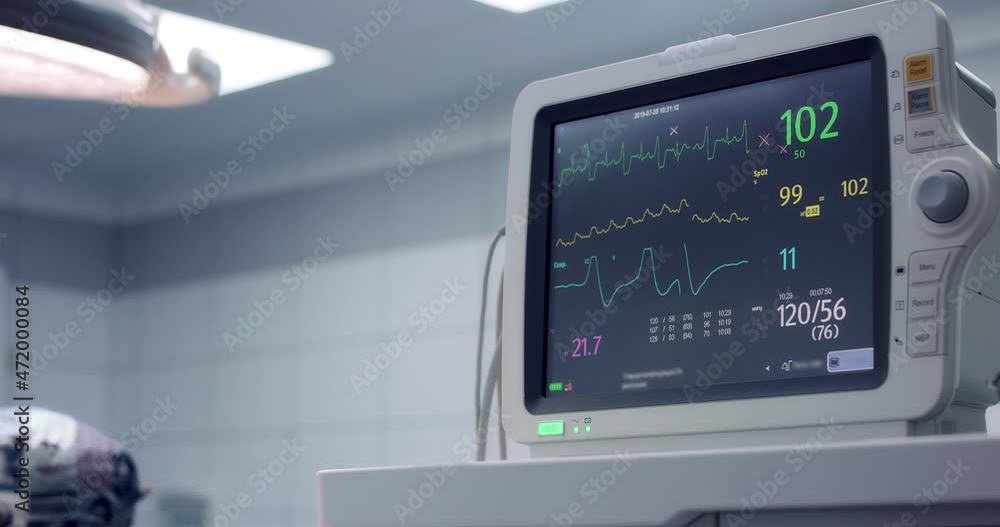 Artificial lung ventilation device. A heart monitor in the clinic. Heart rate monitor during surgery in the surgical department. Life support equipment. SARS-COV-2 COVID-19 Coronavirus Artificial lung ventilation device. A heart monitor in the clinic. Heart rate monitor during surgery in the surgical department. Life support equipment. SARS-COV-2 COVID-19 Coronavirus