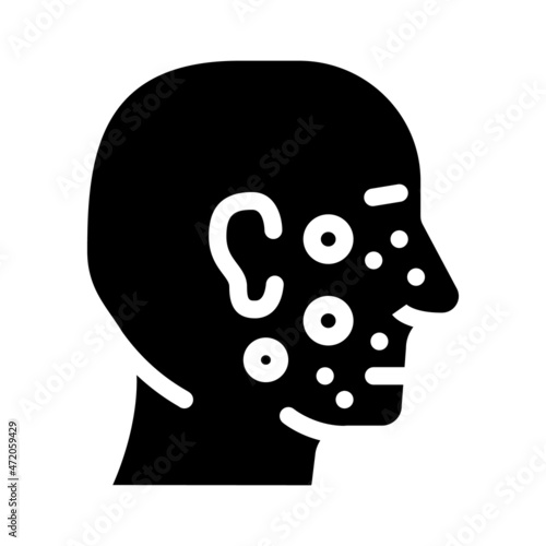 acne facial skin disease glyph icon vector. acne facial skin disease sign. isolated contour symbol black illustration