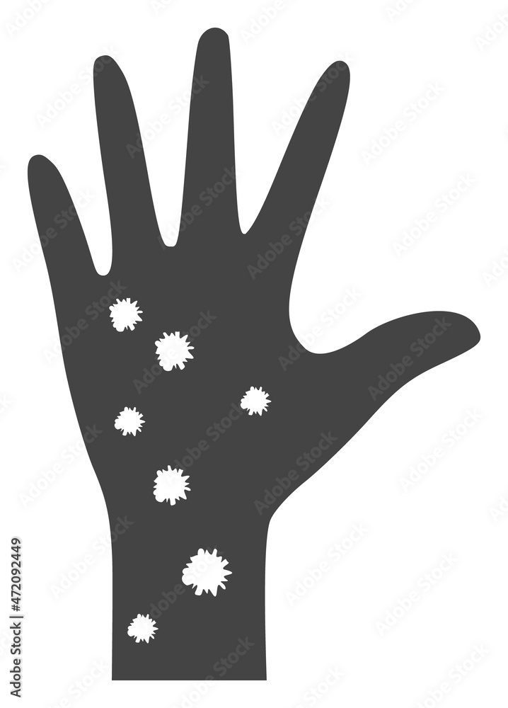 Hand allergy vector icon on a white background. An isolated flat icon illustration of hand allergy. Hand allergy vector icon on a white background. An isolated flat icon illustration of hand allergy.