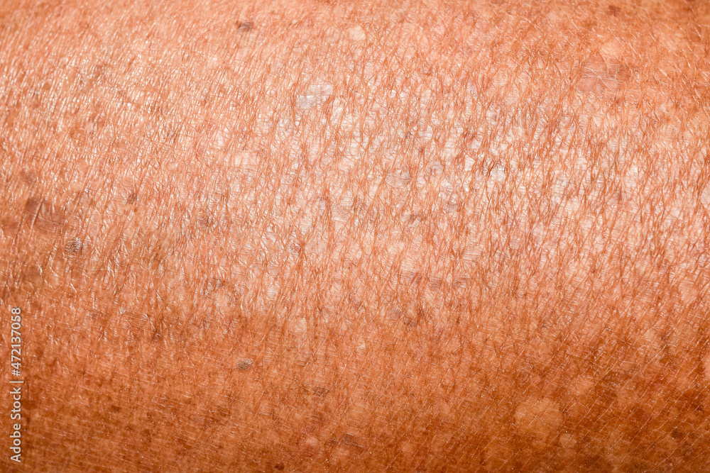 Fototapeta premium brown human skin texture close-up abstract skin background