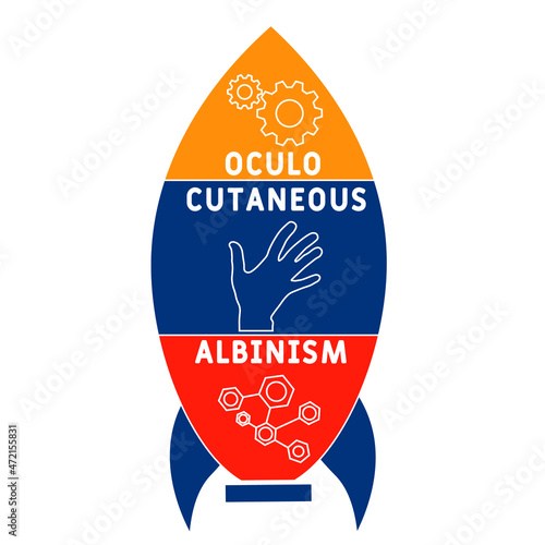 OCA - Oculo Cutaneous Albinism acronym. medical concept background.  vector illustration concept with keywords and icons. lettering illustration with icons for web banner, flyer, landing 