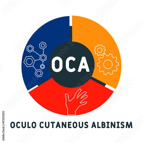 OCA - Oculo Cutaneous Albinism acronym. medical concept background.  vector illustration concept with keywords and icons. lettering illustration with icons for web banner, flyer, landing 