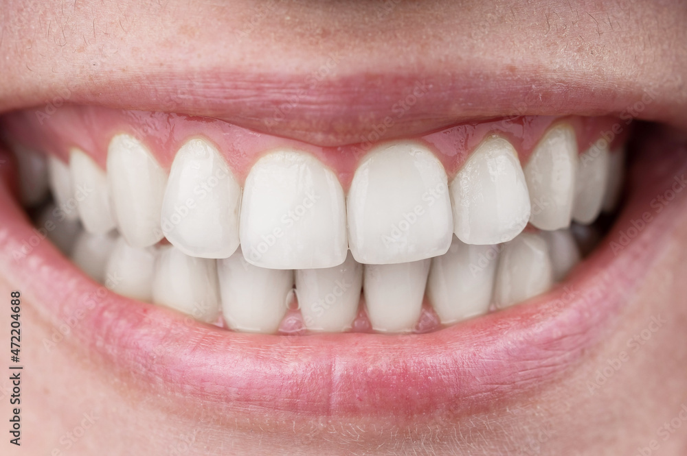 Obraz premium Close-up of a perfect female smile. Macro.