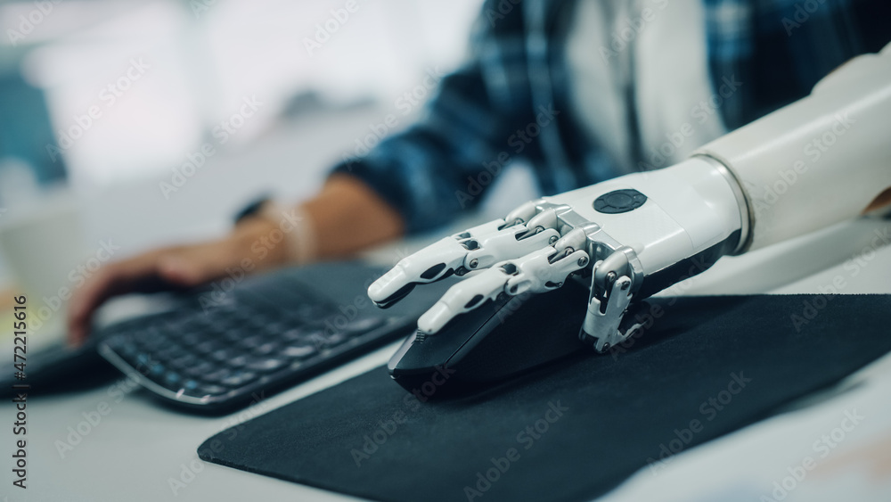 Inclusive Office: Person with Disability Using Prosthetic Arm to Work on Computer. Professional with Advanced Myoelectric Bionic Limb to Control Mouse. Shot with Focus on Hands with Dutch Angle Inclusive Office: Person with Disability Using Prosthetic Arm to Work on Computer. Professional with Advanced Myoelectric Bionic Limb to Control Mouse. Shot with Focus on Hands with Dutch Angle