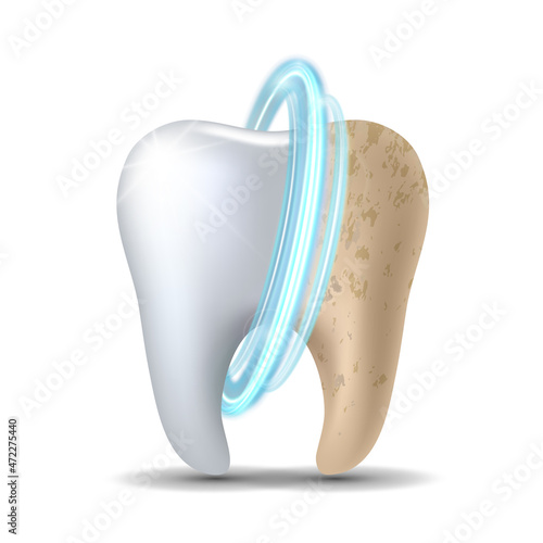 Clean and dirty tooth before and after whitening