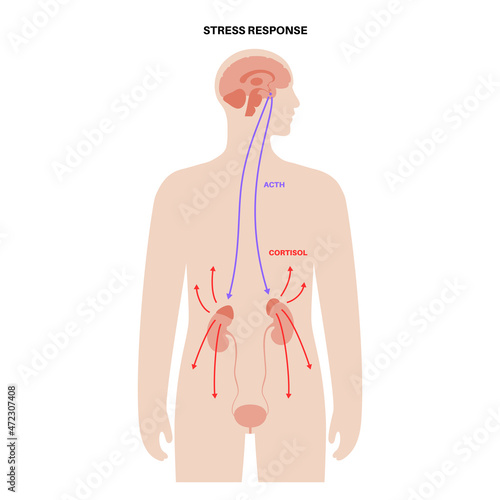 Stress responce system