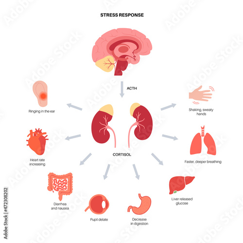 Stress responce system