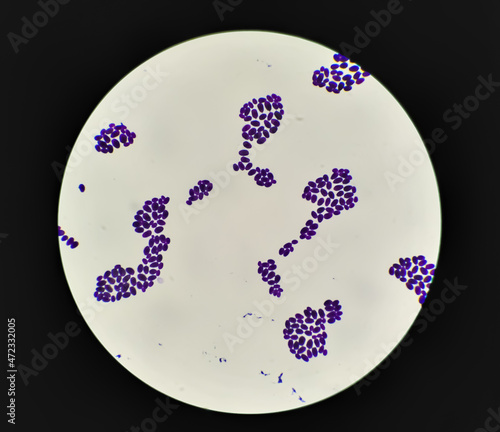 Culture colonies gram stained Microscopic 100x show Candida spp, fungi, emerging multidrug fungus. Candida albicans, C. auris and other yeast fungi. Close up micrograph. laboratory analysis photo