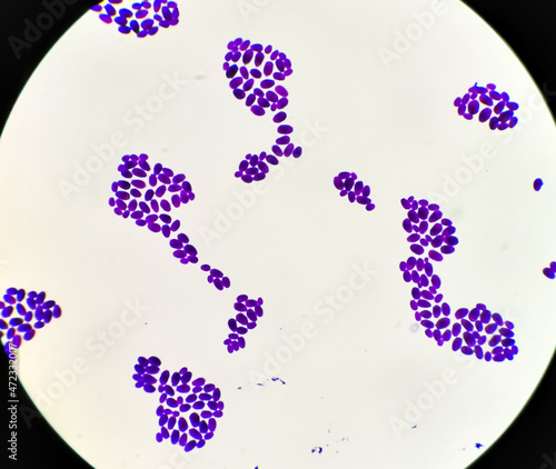 Foto Culture colonies gram stained Microscopic 100x show Candida spp, fungi, emerging multidrug fungus