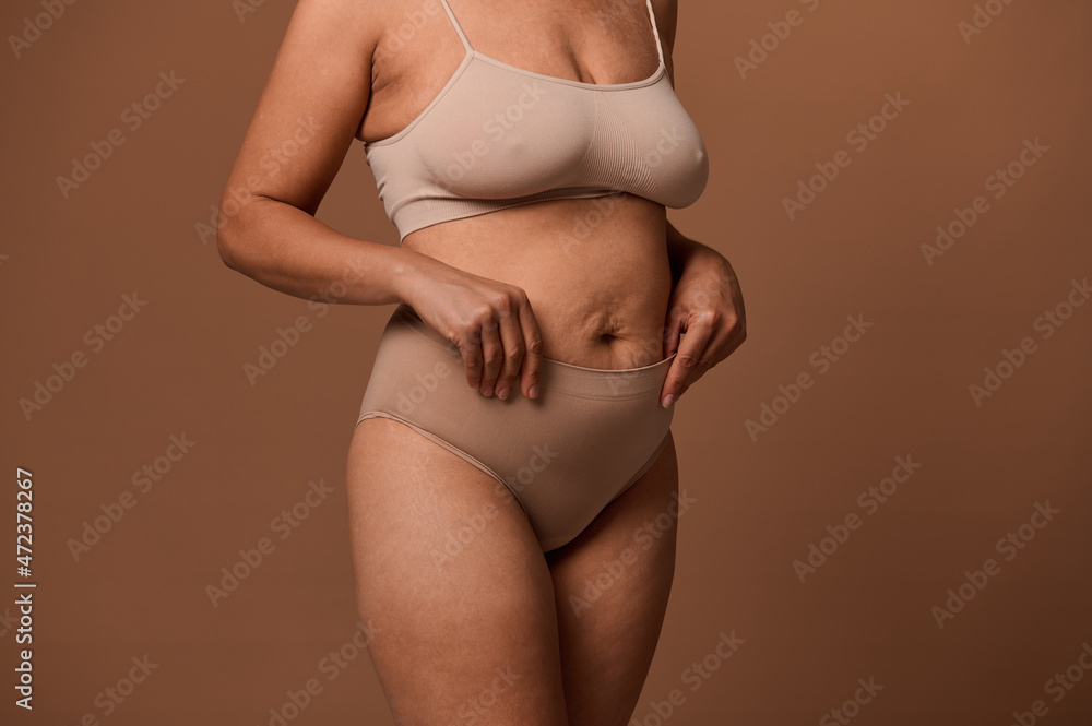 Close-up body of overweight woman with stretch marks and saggy belly after pregnancy, isolated on beige background with copy space for ads. Concept of love and acceptance, body positive.