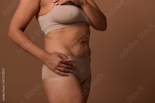 Close-up portrait with female body with flaws, stretch marks and cellulite after childbirth due to leading unhealthy lifestyle during pregnancy. Call to love and self-acceptance, body positivity photo