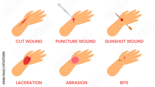 Abstract Flat Doctor Help Types Of Injuries Cut, Puncture, Gunshot, Bite, Laceration First Aid Cartoon People Character Concept Illustration Vector Design Style