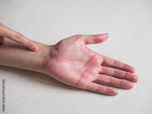 Hand on white background pointing wrist pain