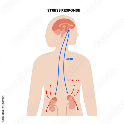 Stress responce system