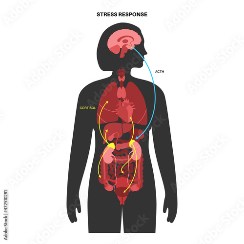 Stress responce system