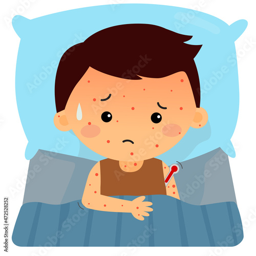 a child has smallpox