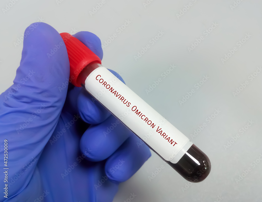 Fototapeta premium Molecular biologist hold blood sample for Coronavirus Omicron Variant test. Omicron b.1.1.529. african new covid-19 variant