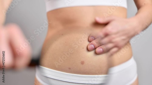 Woman is checking birthmark on her skin closeup