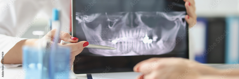 Professional dentist shows patient x-rays of jaws and teeth using digital tablet device