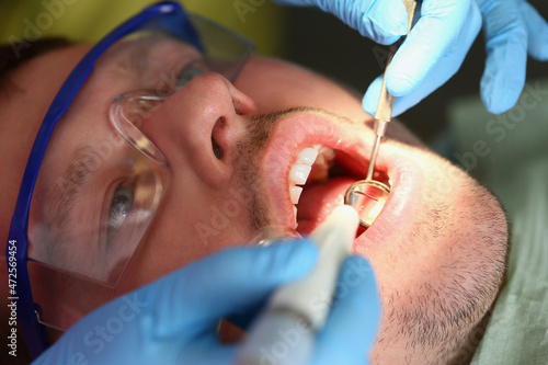 A man treats teeth  a patient s calm face close-up