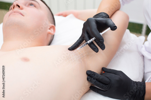 Closeup of a doctor hands in medical gloves with a syringe performs botox injections into the armpit for a young man to prevent excessive sweating