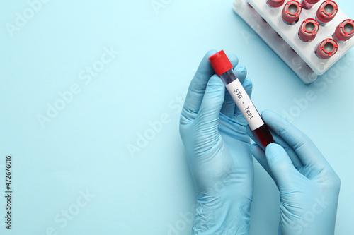 Scientist holding tube with blood sample and label STD Test on light blue background, top view. Space for text photo