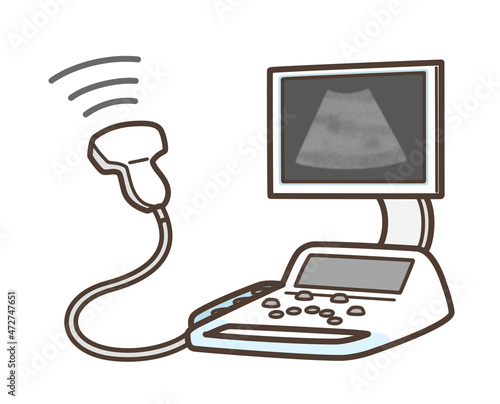 超音波診断装置