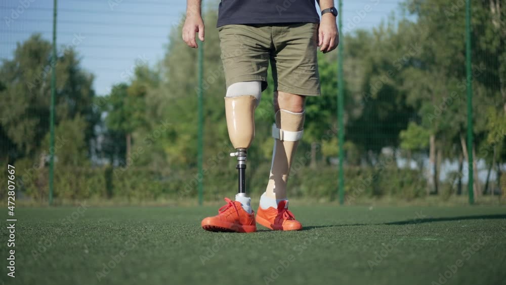 Front view unrecognizable amputee with artificial legs playing soccer in slow motion on sunny summer day outdoors. Adult motivated Caucasian man with prosthesis kicking ball on green grass Front view unrecognizable amputee with artificial legs playing soccer in slow motion on sunny summer day outdoors. Adult motivated Caucasian man with prosthesis kicking ball on green grass