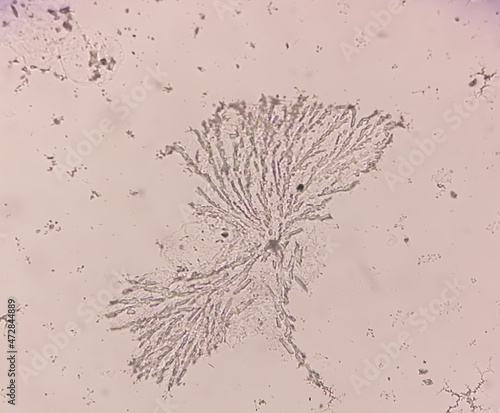 Microscopic view of dermatophytes. fungus test. 100X. Diagnosis for fungal infection. photo