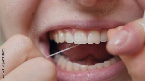 Close-up shot of a woman flossing her teeth while removing leftover food from the interdental space