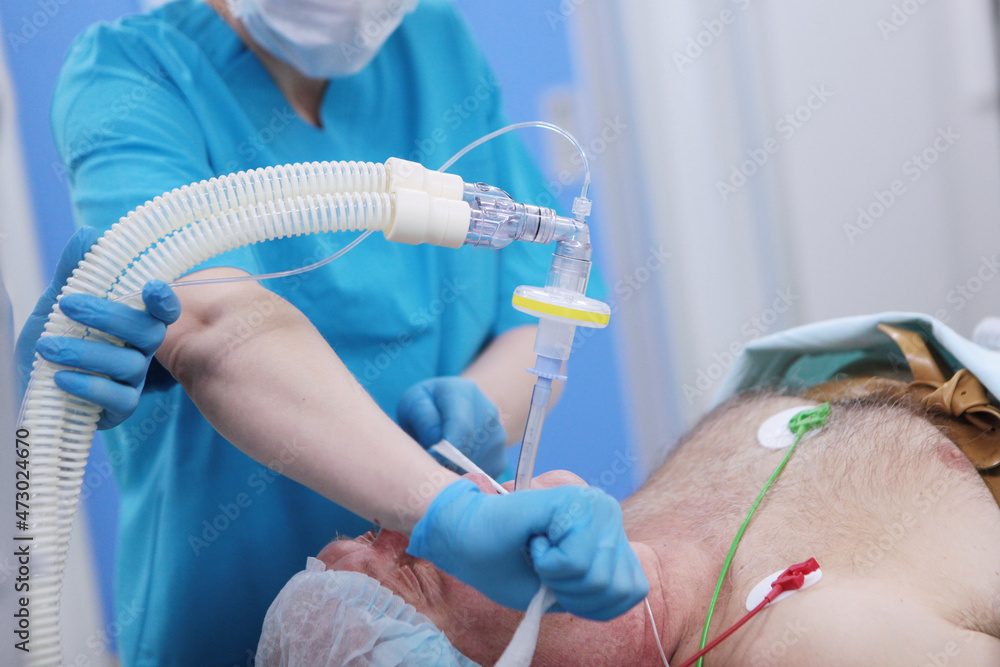 Installation of a breathing tube during anesthesia. A breathing mask on