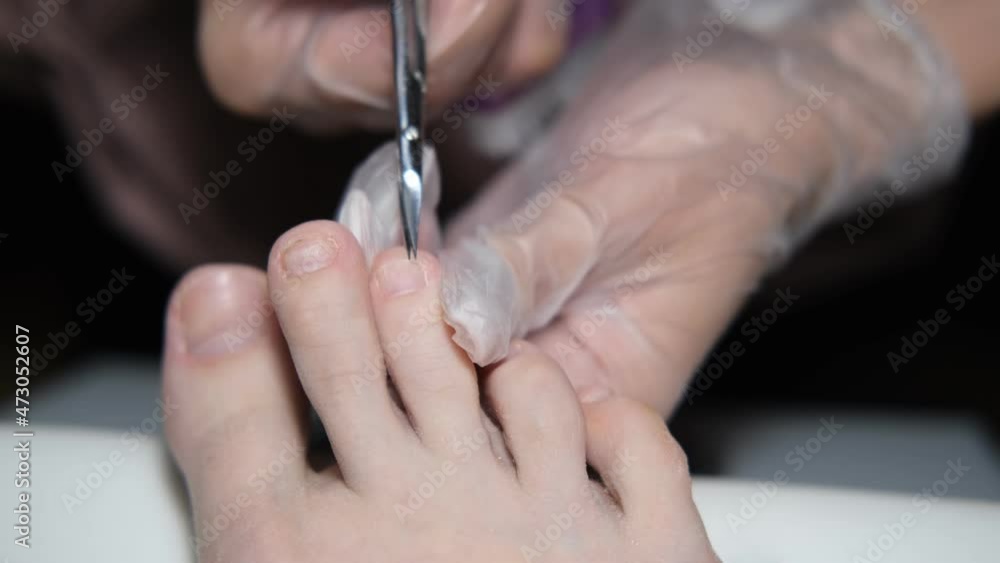Patient on medical pedicure procedure, visiting podiatrist.Peeling feet with special electric device.Foot treatment in SPA salon.Podiatry clinic. Patient on medical pedicure procedure, visiting podiatrist.Peeling feet with special electric device.Foot treatment in SPA salon.Podiatry clinic.