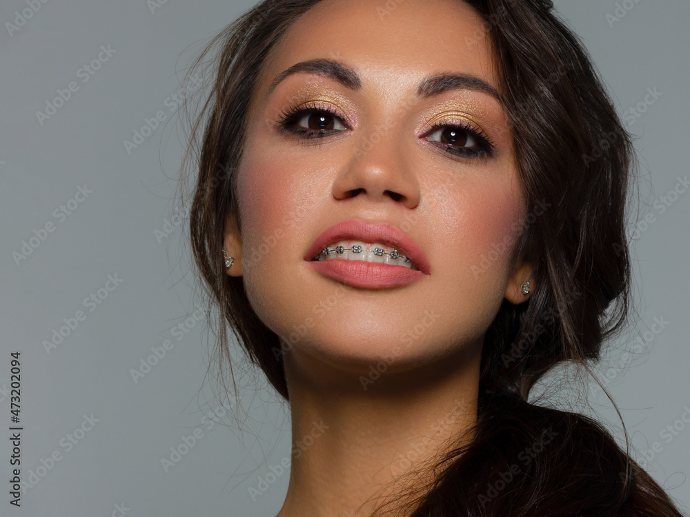 Close-up of woman's lips with fashion bright pink make-up and braces. Beautiful female mouth, full lips with perfect makeup. Part of female face. Choice lipstick. Brunet wavy hair of a Barbie doll Close-up of woman's lips with fashion bright pink make-up and braces. Beautiful female mouth, full lips with perfect makeup. Part of female face. Choice lipstick. Brunet wavy hair of a Barbie doll