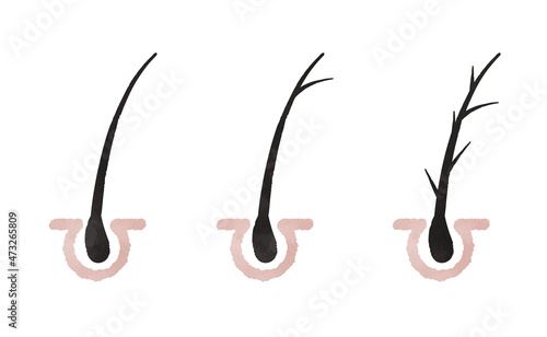 Cute hair root illustration set
