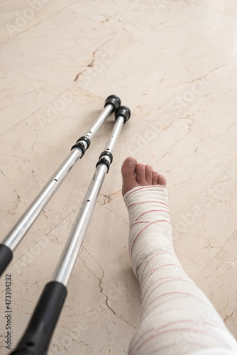 leg in bandage and crutches