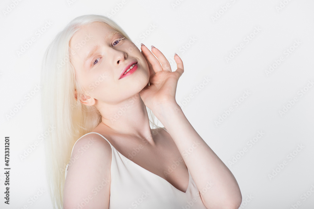 Smiling albino model looking at camera isolated on white. Smiling albino model looking at camera isolated on white.