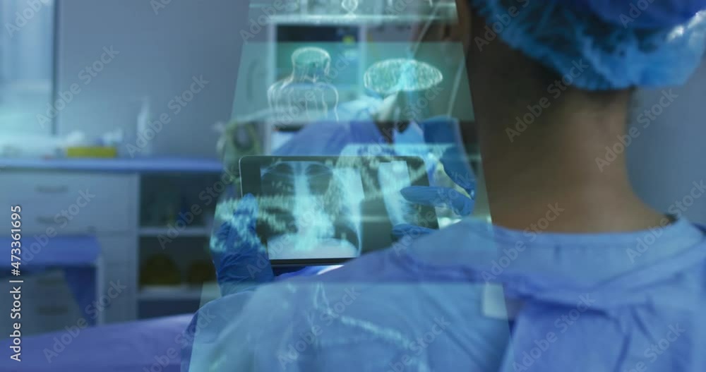 Animation of digital screens over diverse doctors with face masks during surgery Animation of digital screens over diverse doctors with face masks during surgery