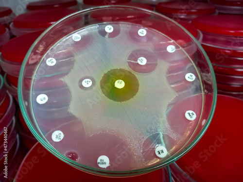 Antimicrobial susceptibility testing in culture plate. Drug sensitivity test, disk drug, antibiotic sensitivity. All basic usable antibiotic are sensitive eccept Levofloxacin antibiotic. photo