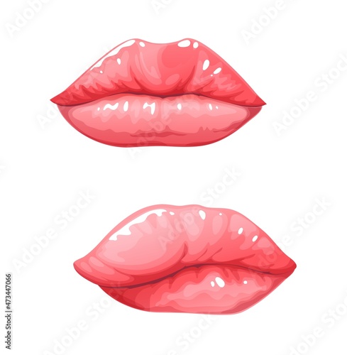 Edema or angioedema  medical swelling of lips  lipedema  disease of face or skin. Vector edema urticaria or lipedema of lips form allergenic drugs or virus infection and female hormonal reaction