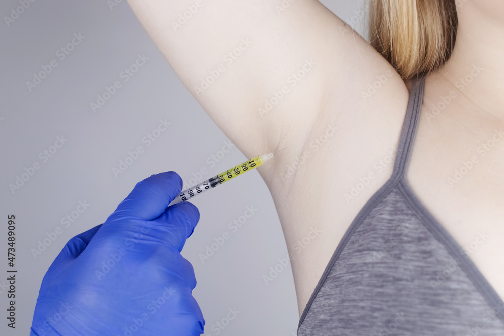 Woman receiving botulinum toxin injection in armpit as treatment of hyperhidrosis in clinic. Treatment of problems with increased sweating, anhidrosis, or malfunctioning glands. Cosmetology Woman receiving botulinum toxin injection in armpit as treatment of hyperhidrosis in clinic. Treatment of problems with increased sweating, anhidrosis, or malfunctioning glands. Cosmetology