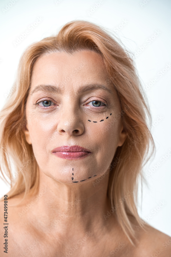 Attractive woman looking at the camera before lifting procedure Attractive woman looking at the camera before lifting procedure
