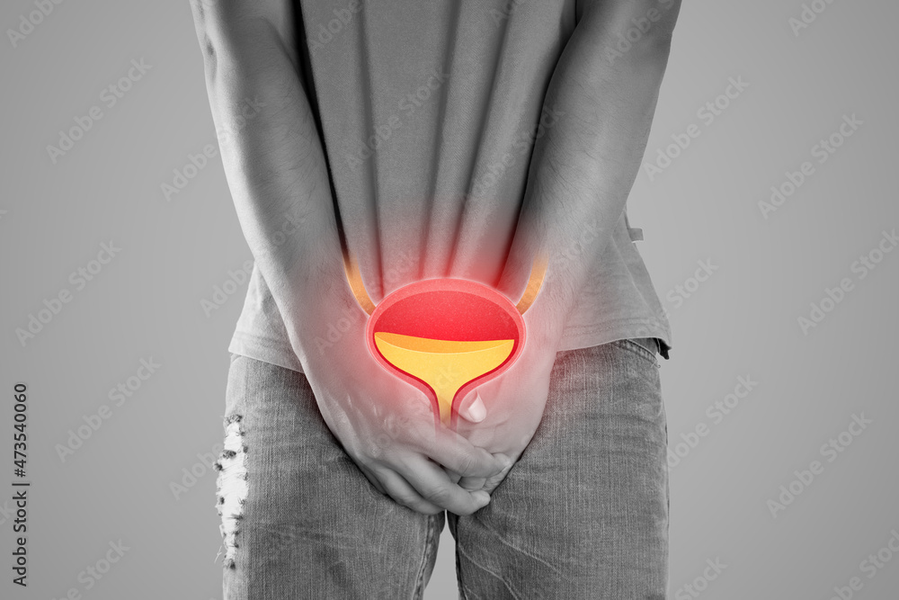 Жжение мочеиспускательного. Дифференциальная диагностика цистита и пиелонефрита таблица. Жжение мочеиспускательного. Жжение мочеиспускательного. Жжение мочеиспускательного.