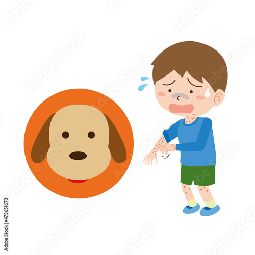 犬アレルギーで蕁麻疹が出る男の子
