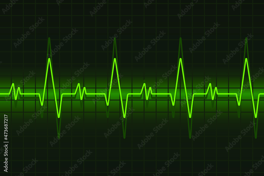 Heart pulse monitor with signal. Heart beat in green, ekg, vector illustration Heart pulse monitor with signal. Heart beat in green, ekg, vector illustration