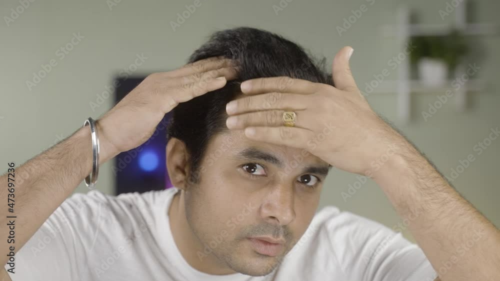 Close up shot of worried Young man checking white hairs or Hair loss by looking Camera - concept of alopecia , Haircare and dandruff problem. Close up shot of worried Young man checking white hairs or Hair loss by looking Camera - concept of alopecia , Haircare and dandruff problem.