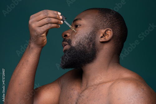 African man with skin problems applying oil photo