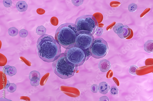 Acute myeloid leukemia (AML) cells cluster in blood flow - isometric view 3d illustration photo