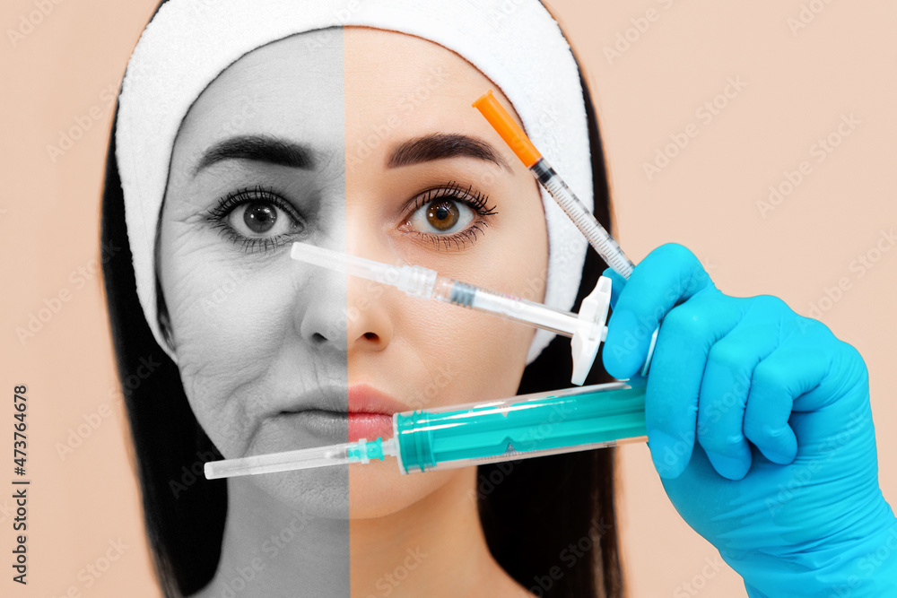 Results before and after cosmetic procedures. Close up portrait of a woman holding three syringes in hands near the face. Beige background. The concept of plastic surgery and rejuvenations injections Results before and after cosmetic procedures. Close up portrait of a woman holding three syringes in hands near the face. Beige background. The concept of plastic surgery and rejuvenations injections