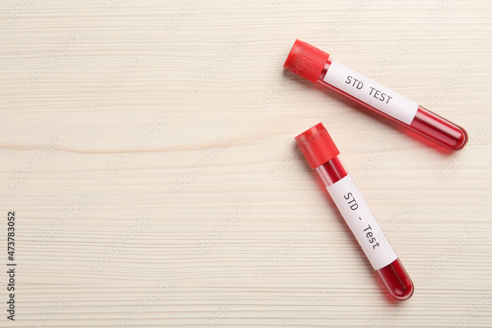 Tubes with blood samples and labels STD Test on white wooden table, flat lay. Space for text Tubes with blood samples and labels STD Test on white wooden table, flat lay. Space for text
